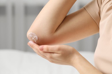 Photo of Young woman with dry skin applying cream onto her elbow indoors, closeup