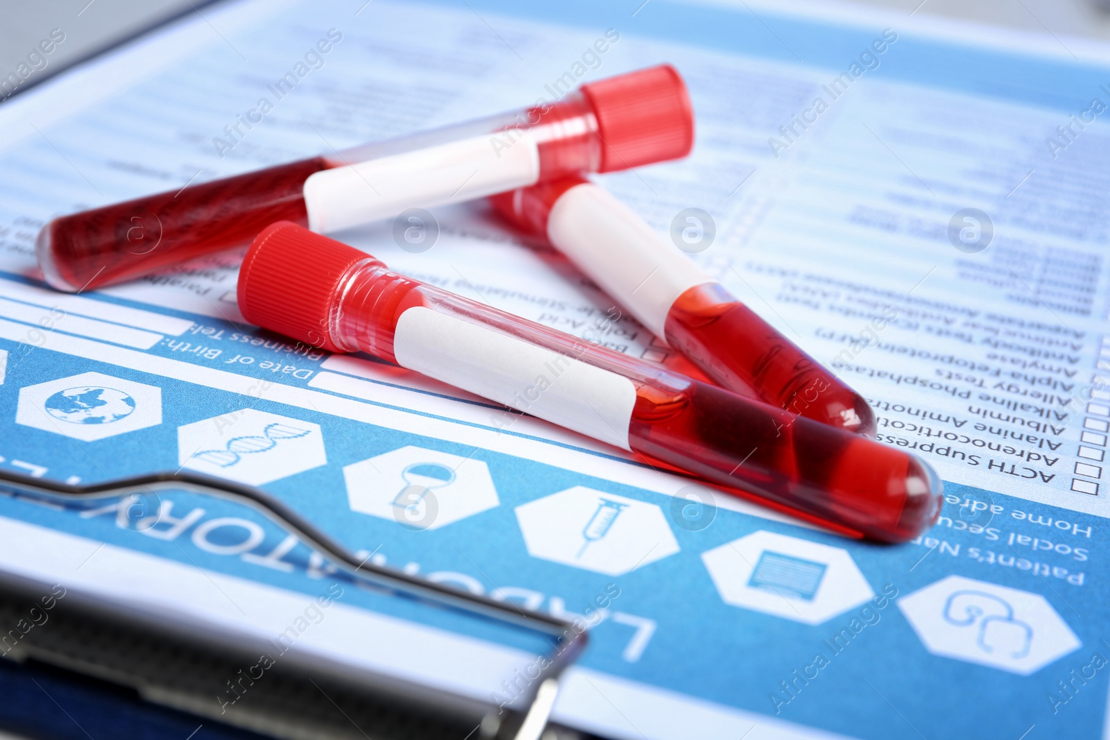 Photo of Sample tubes with blood on laboratory test form, closeup. Research and analysis