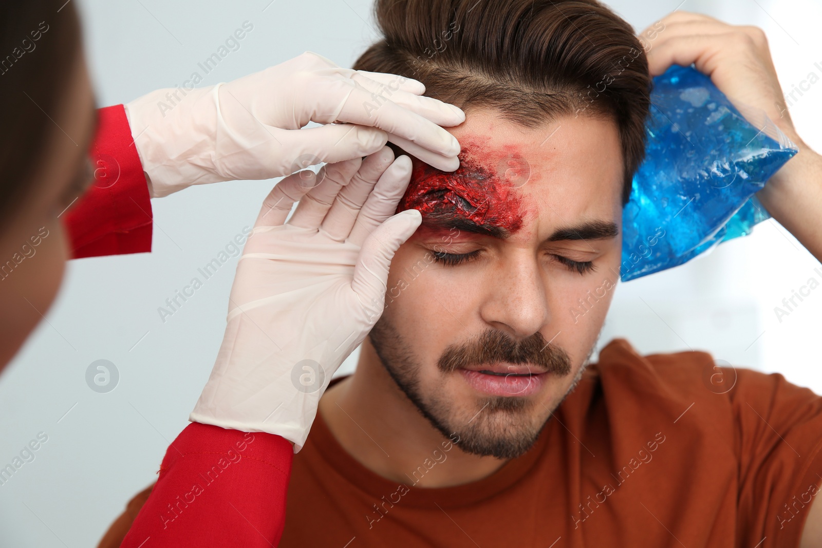 Photo of Nurse examining young man's head injury in clinic. First aid