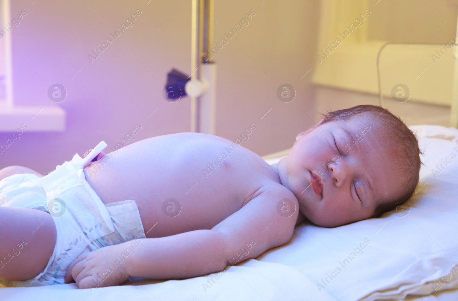 Photo of Newborn child under ultraviolet light in hospital
