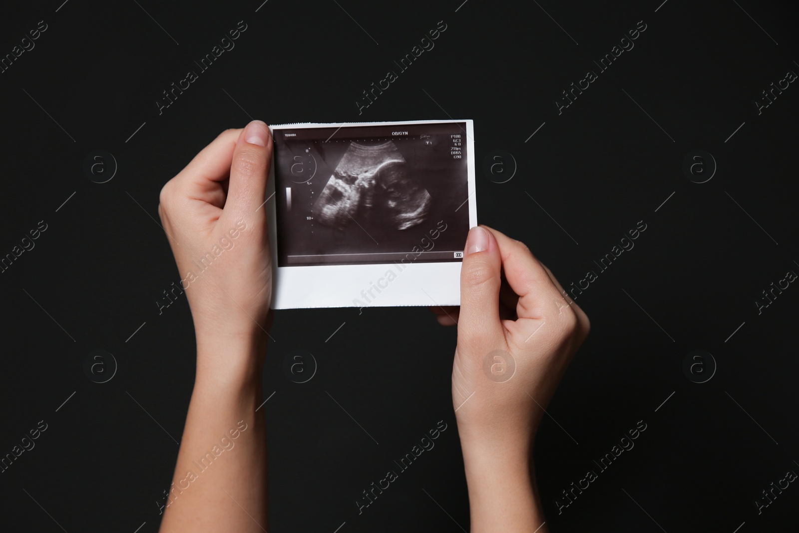 Photo of Woman holding ultrasound picture of baby on black background, closeup