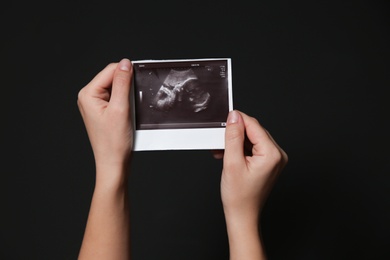 Woman holding ultrasound picture of baby on black background, closeup