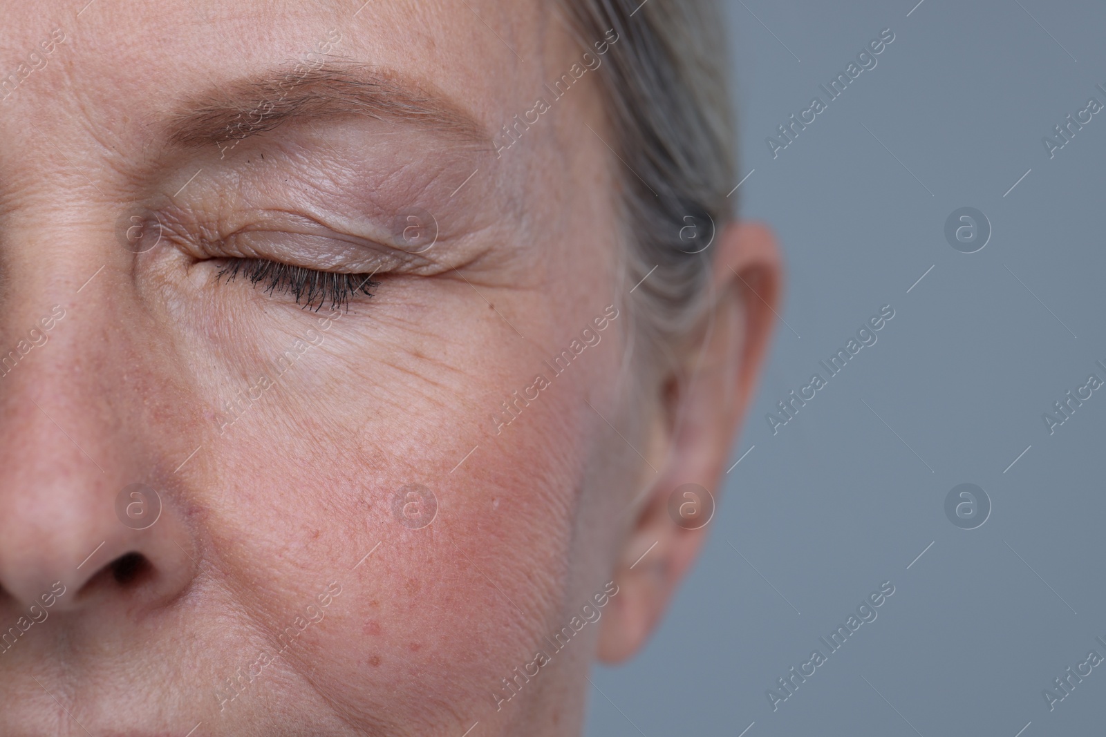 Photo of Senior woman with aging skin on grey background, closeup and space for text. Rejuvenation treatment