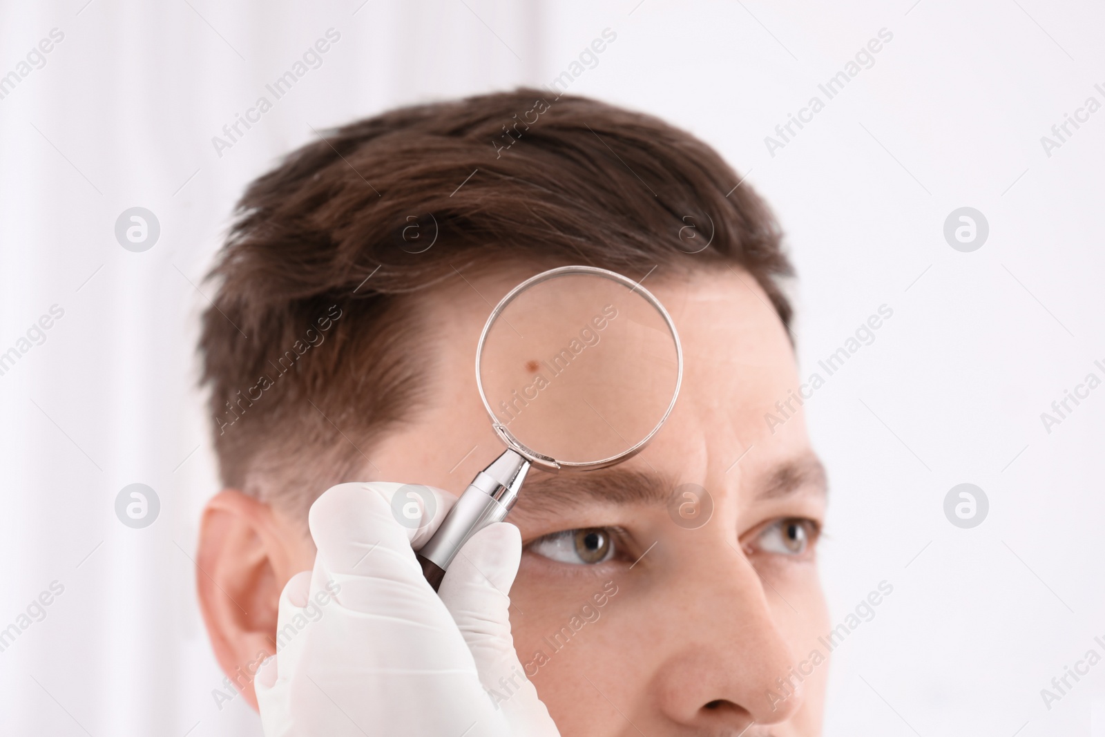 Photo of Dermatologist examining patient with magnifying glass in clinic, closeup view