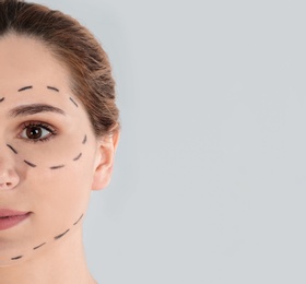 Woman with marks on face against grey background, space for text. Cosmetic surgery