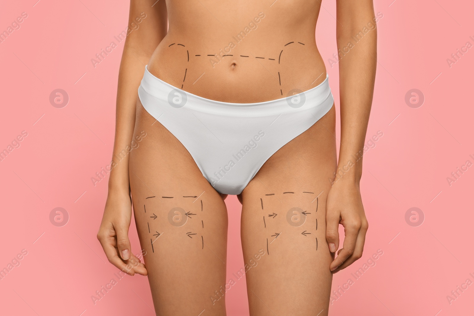 Photo of Slim woman with markings on body before cosmetic surgery operation on pink background, closeup