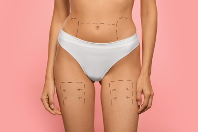Photo of Slim woman with markings on body before cosmetic surgery operation on pink background, closeup