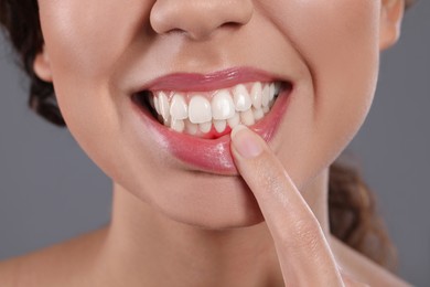 Photo of Young woman showing inflamed gums on grey background, closeup