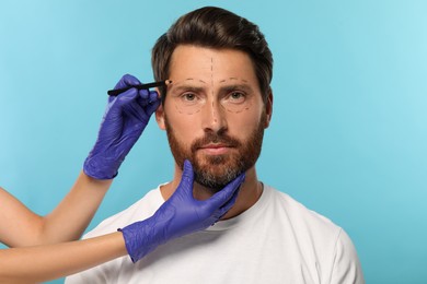 Doctor with pencil preparing patient for cosmetic surgery operation on light blue background