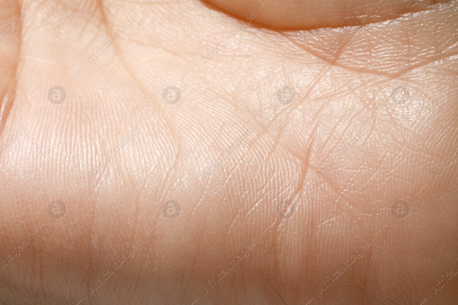 Photo of Closeup view of human hand with dry skin