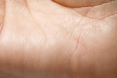 Closeup view of human hand with dry skin