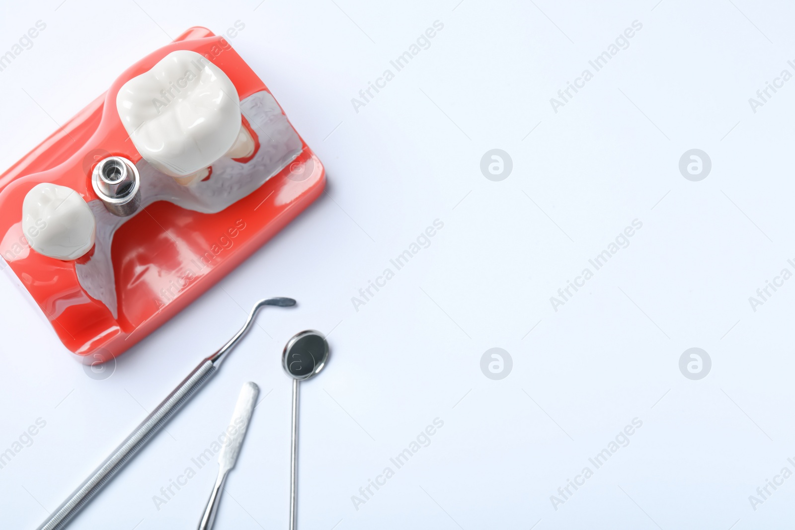 Photo of Educational model of gum with post for dental implant between teeth and medical tools on white background, top view