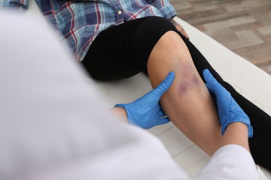 Photo of Doctor checking boy's leg with bruise at hospital, closeup