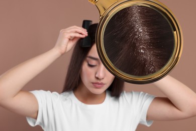 Woman suffering from dandruff on pale brown background. View through magnifying glass on hair with flakes