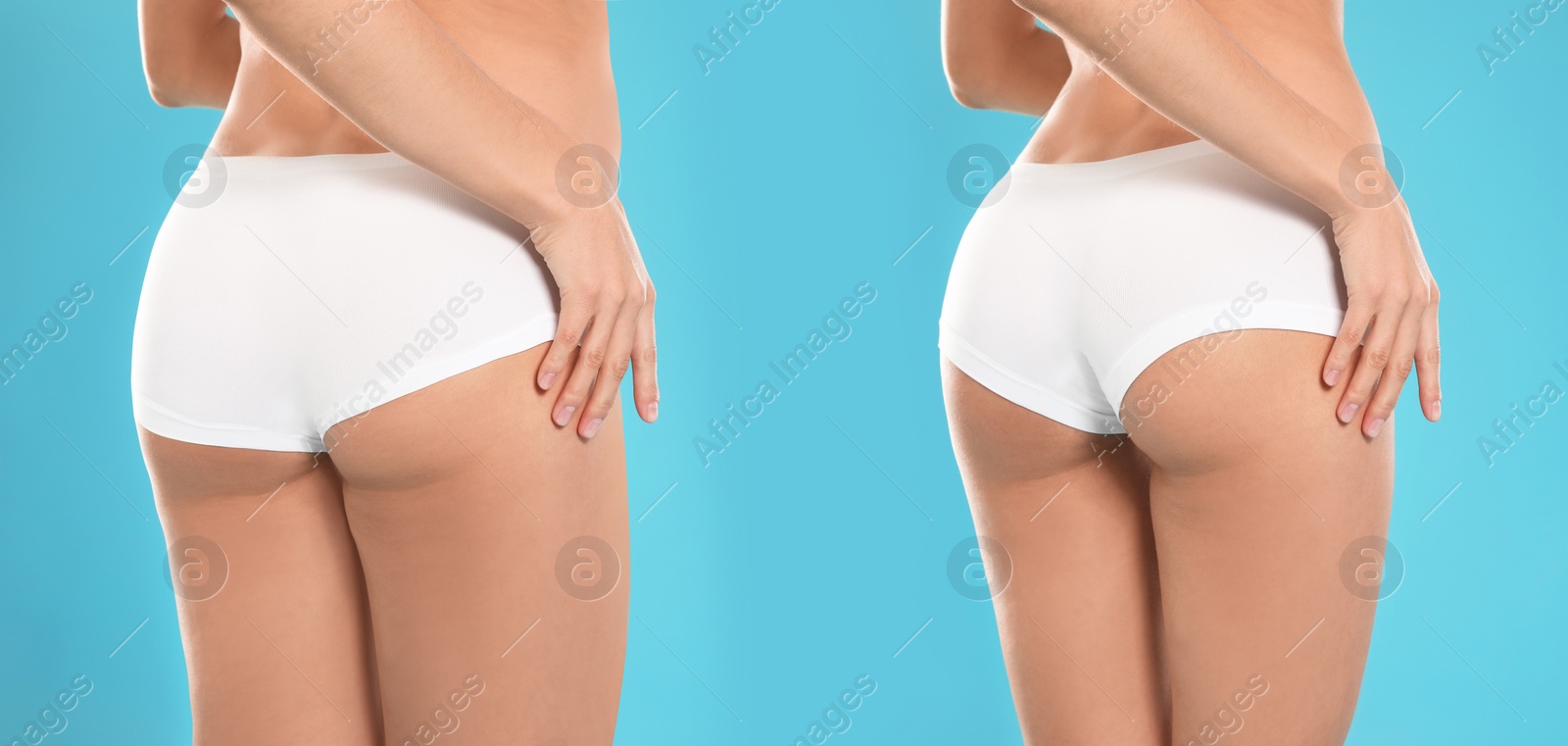 Image of Collage with photos of woman before and after weight loss diet on light blue background, closeup. Banner design