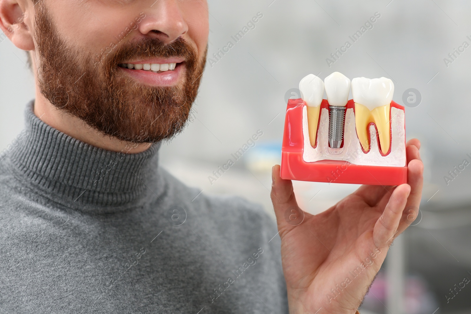 Photo of Man holding educational model of dental implant on blurred background, closeup