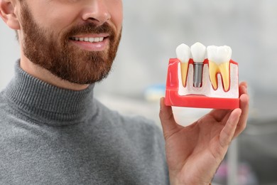 Man holding educational model of dental implant on blurred background, closeup