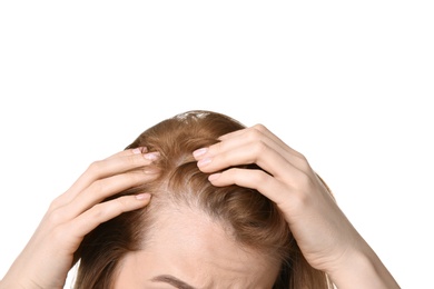 Young woman with hair loss problem on white background