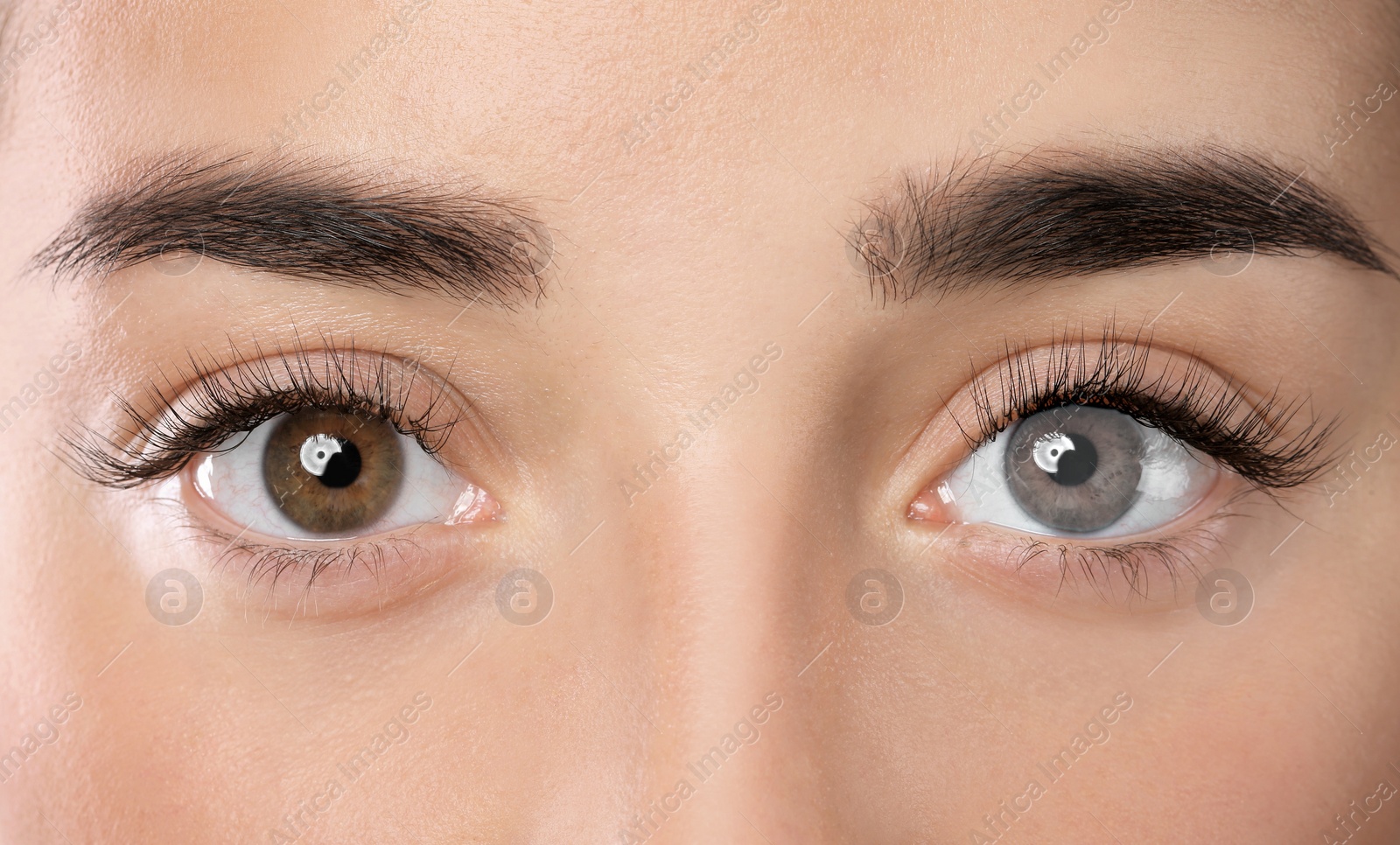 Image of Woman with different colors of eyes, closeup. Heterochromia iridis