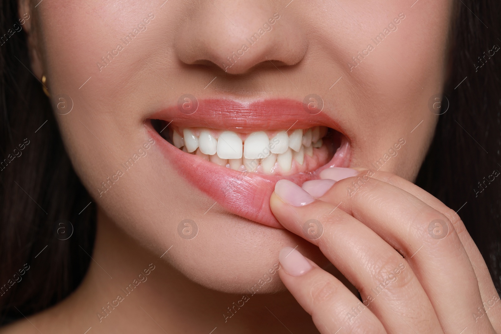 Photo of Young woman showing healthy gums, closeup view