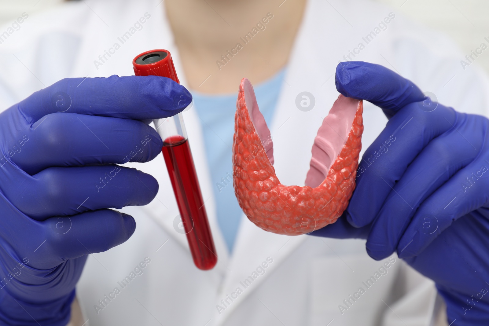 Photo of Endocrinologist showing thyroid gland model and blood sample in test tube, closeup