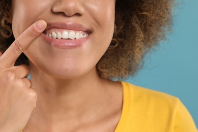 Woman showing her clean teeth on light blue background, closeup