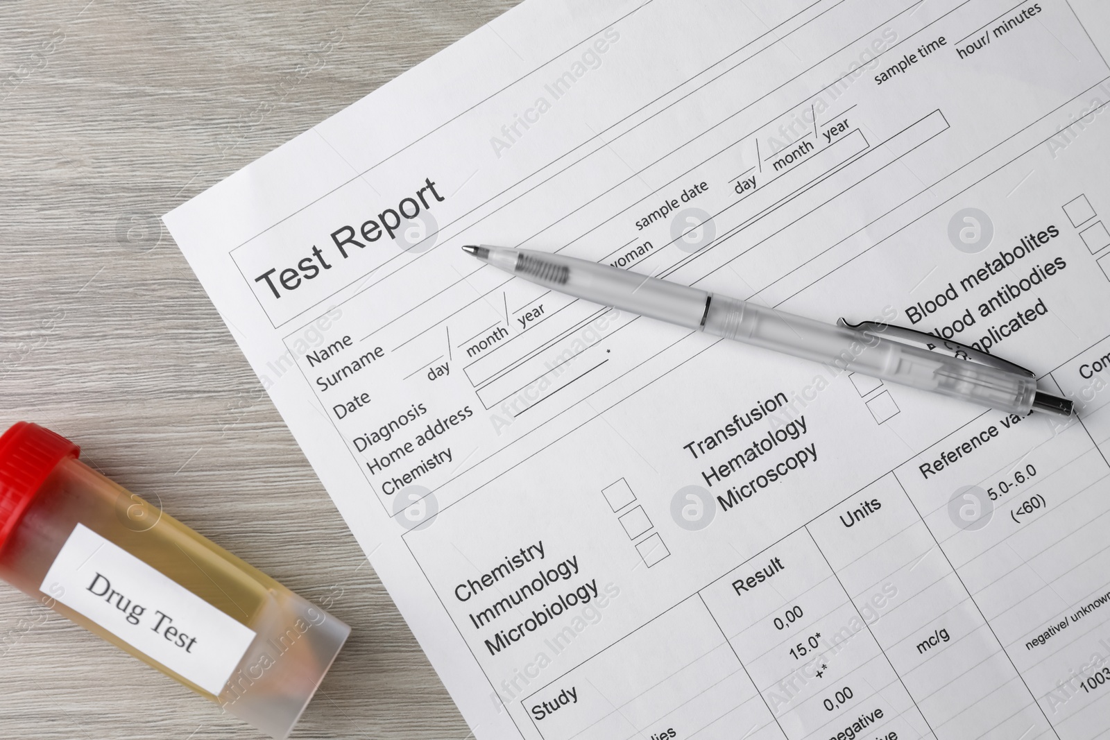 Photo of Drug test result form, container with urine sample and pen on wooden table, flat lay