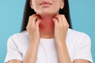 Photo of Suffering from allergy. Young woman scratching her neck on light blue background, closeup