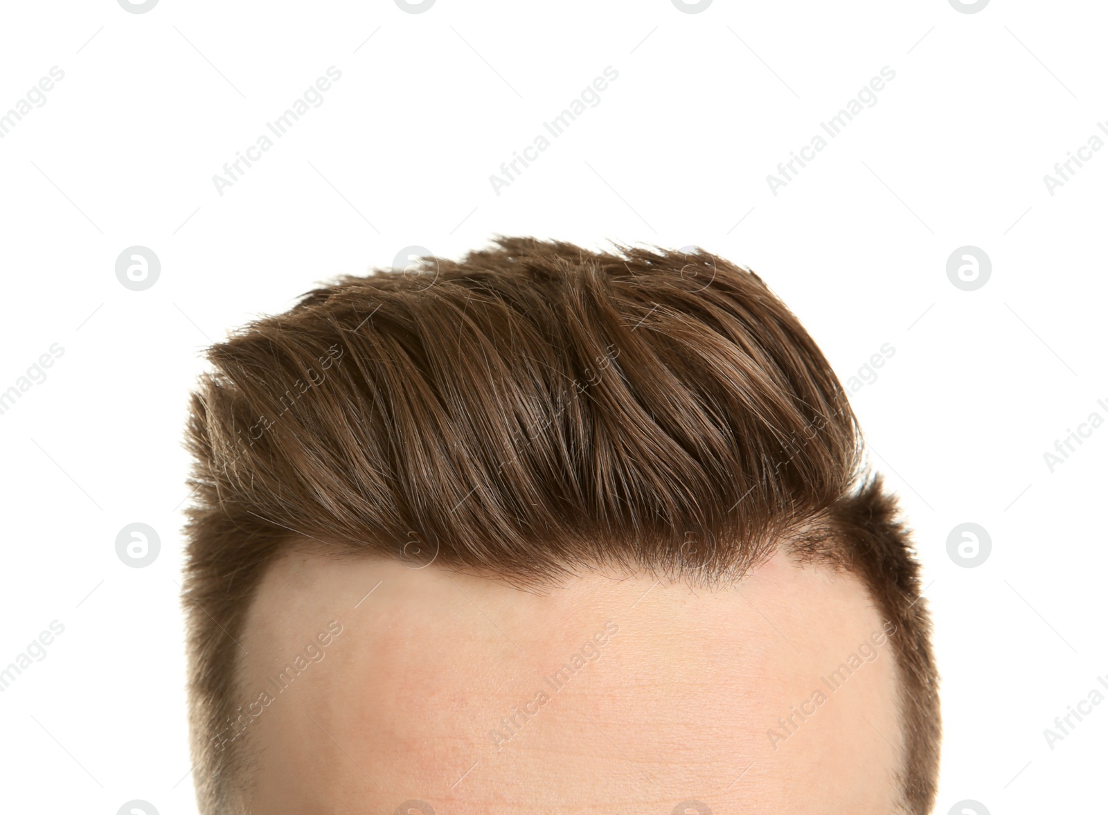 Photo of Young man with hair loss problem on white background