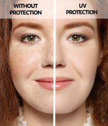 Image of Young woman without and with sun protection cream on her face, closeup