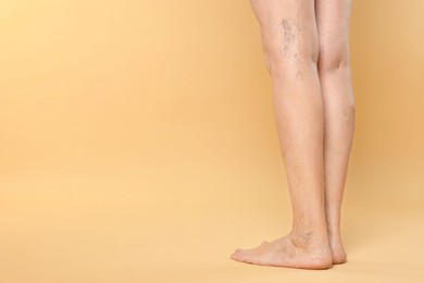 Closeup view of woman with varicose veins on yellow background. Space for text