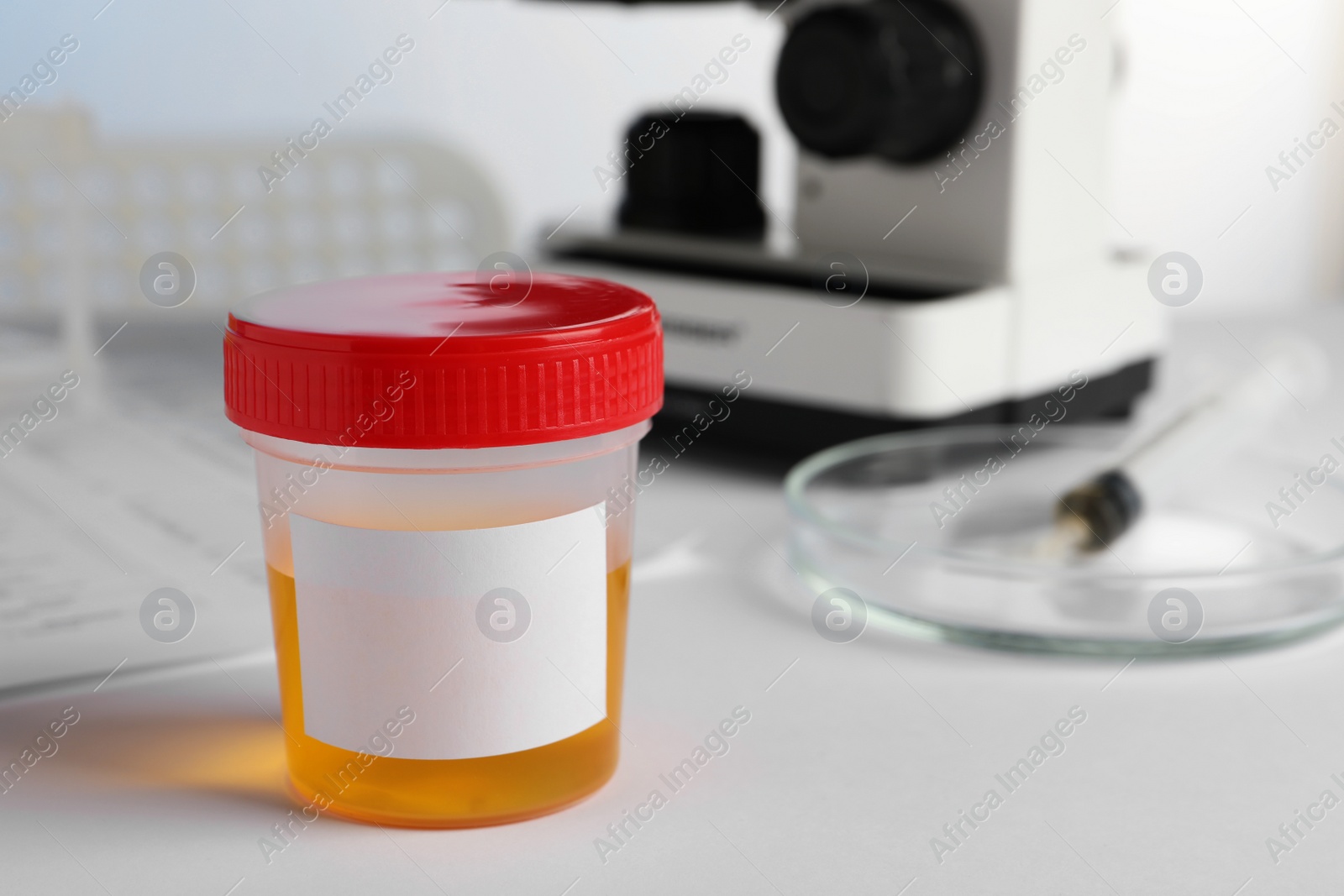 Photo of Container with urine sample on white table in laboratory, space for text. Specimen collection