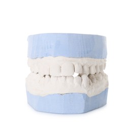 Photo of Dental model with gums isolated on white. Cast of teeth