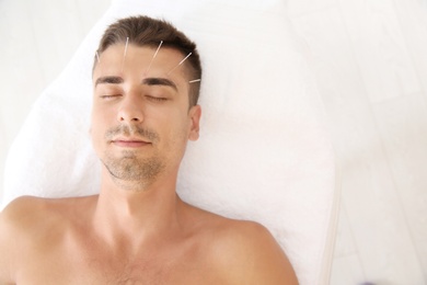 Young man undergoing acupuncture treatment in salon