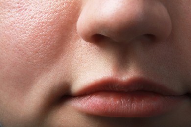 Photo of Closeup view of woman with normal skin and beautiful lips