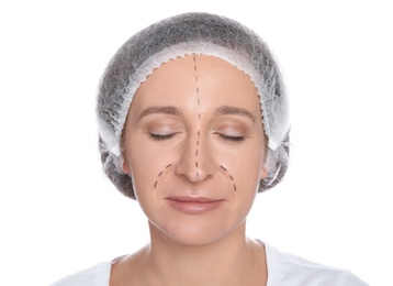 Portrait of woman with marks on face preparing for cosmetic surgery against white background
