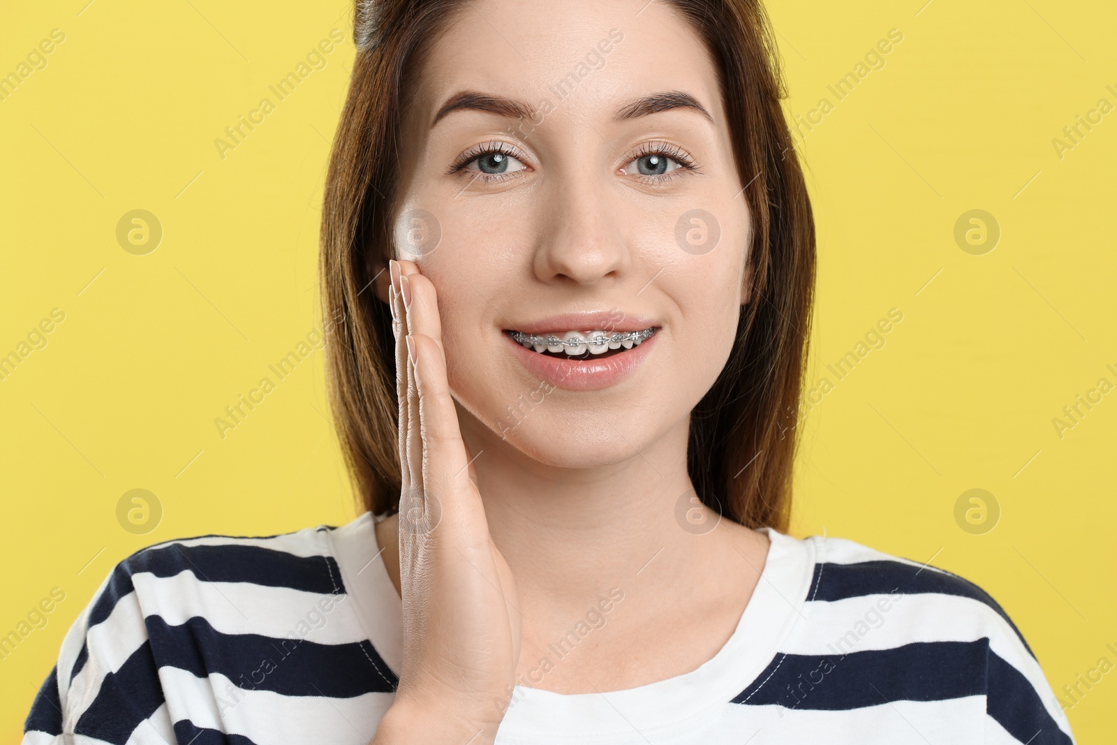 Photo of Portrait of smiling woman with dental braces on yellow background, closeup