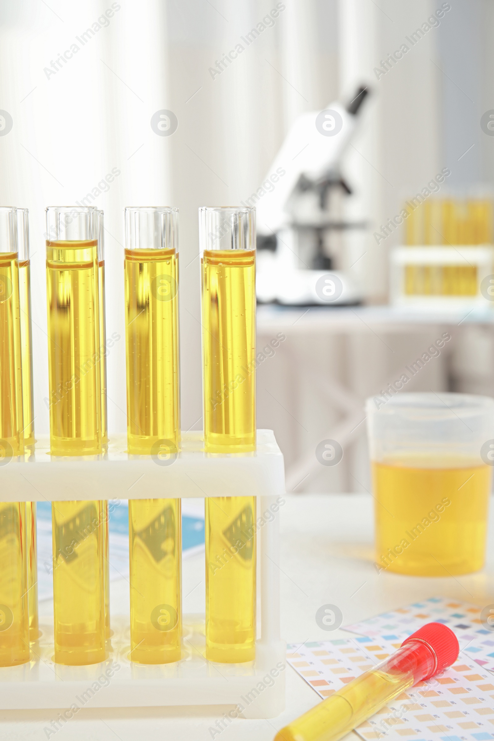 Photo of Test tubes with urine samples for analysis on white table in laboratory