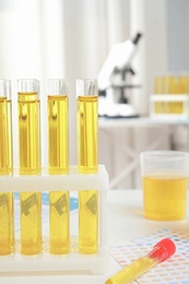 Photo of Test tubes with urine samples for analysis on white table in laboratory