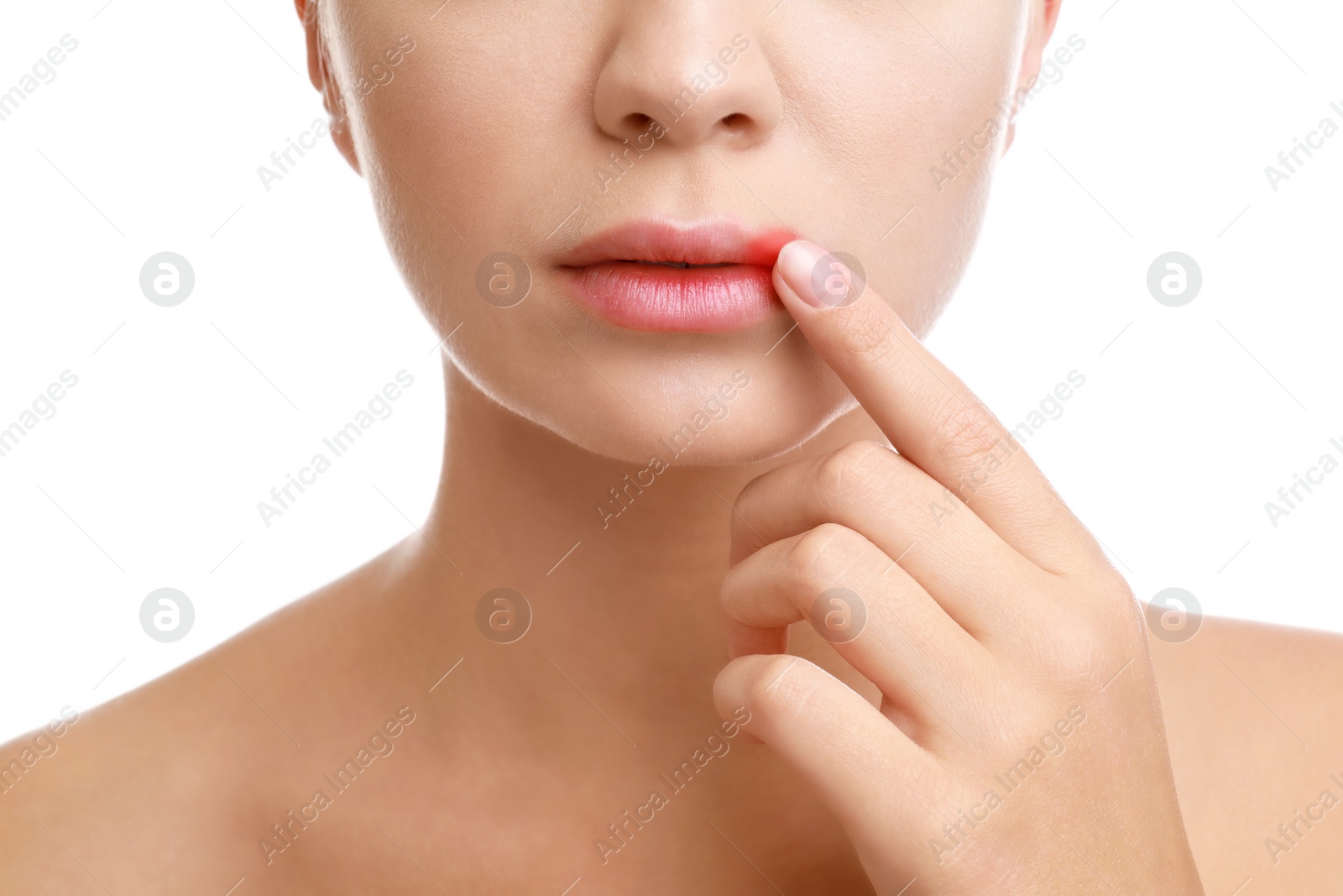 Photo of Young woman with cold sore touching lips against white background, closeup