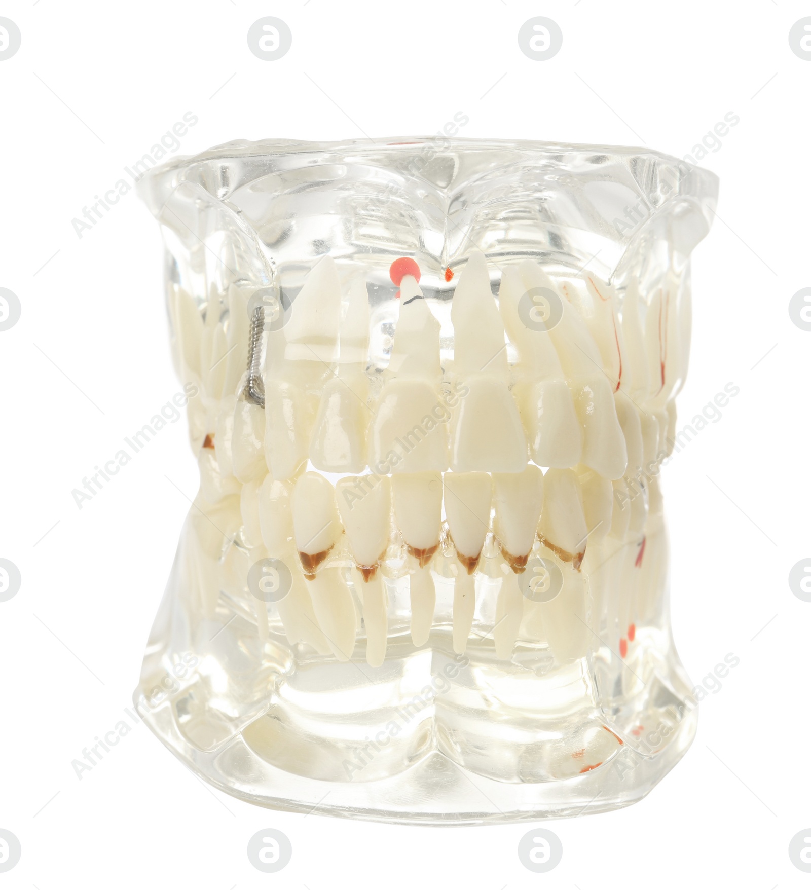 Photo of Educational model of oral cavity with teeth on white background