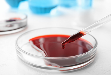 Image of Dripping blood from pipette into Petri dish on table, closeup. Laboratory analysis