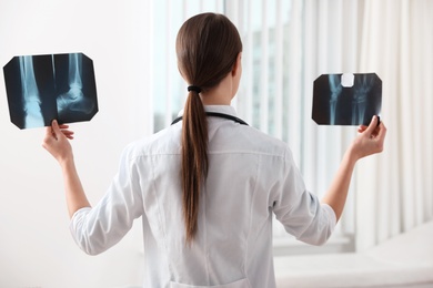 Photo of Orthopedist examining X-ray pictures near window in office