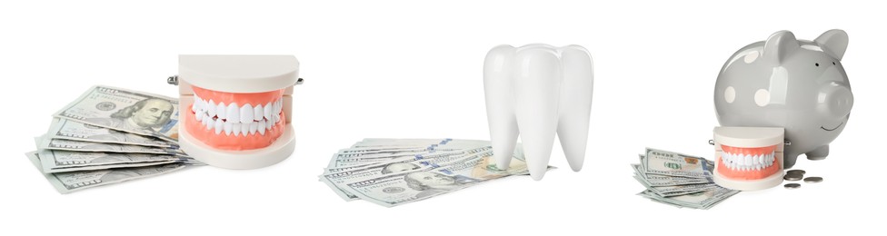 Image of Set with educational dental models and money on white background, banner design. Expensive teeth treatment