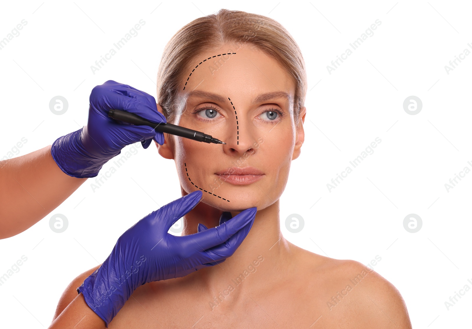 Image of Woman preparing for cosmetic surgery, white background. Doctor drawing markings on her face, closeup