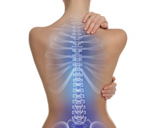 Image of Woman with healthy spine on white background, back view