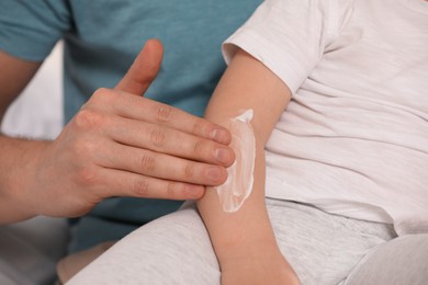 Photo of Father applying ointment onto his son`s arm, closeup
