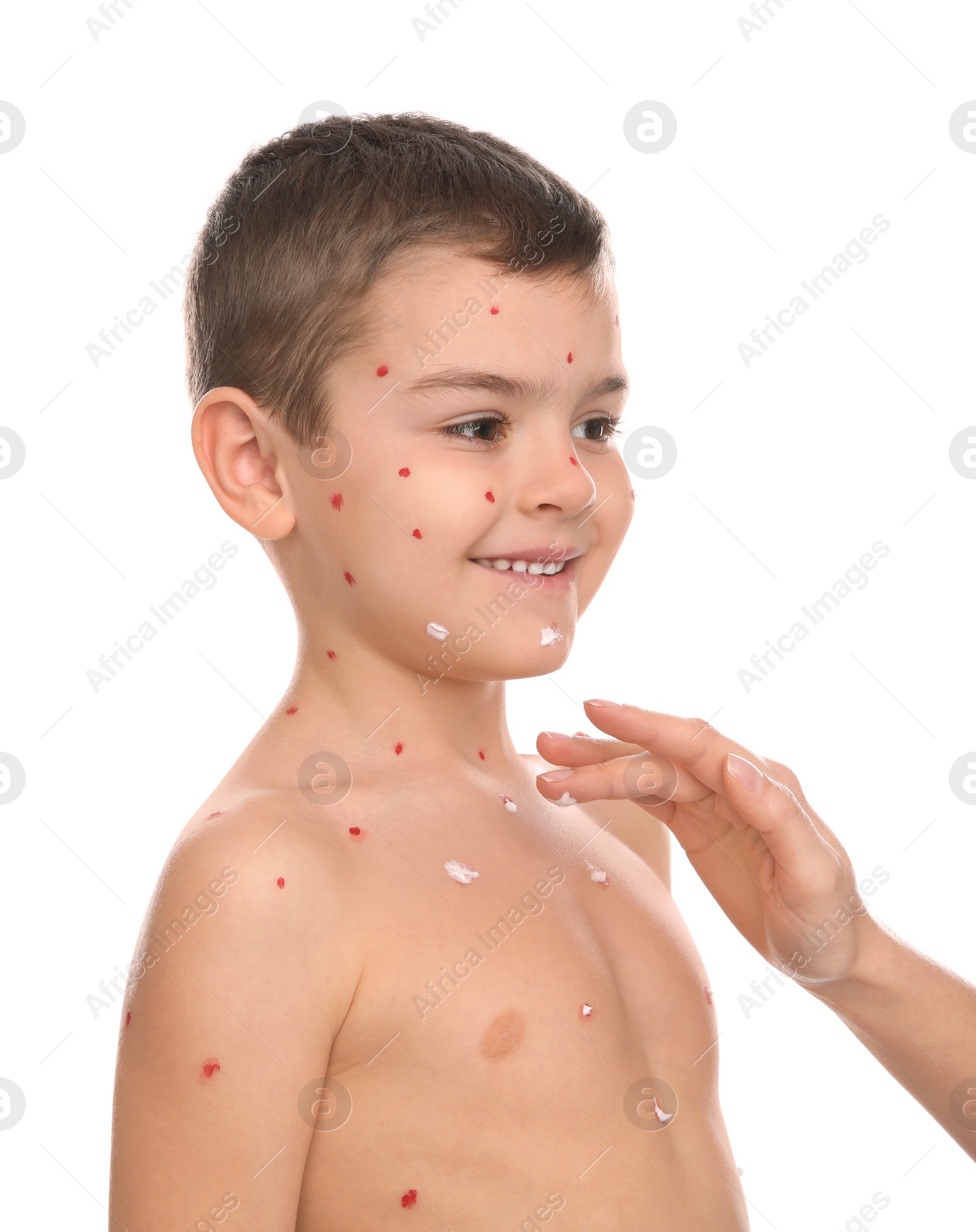 Photo of Woman applying cream onto skin of little boy with chickenpox on white background