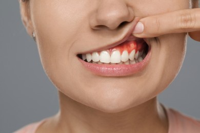 Woman showing inflamed gum on grey background, closeup