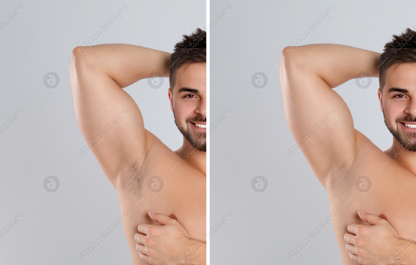 Image of Collage of man showing armpit before and after epilation on light grey background